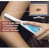 Zadro Digital Imaging Camera Wand with Adjustable Lighting (DICW01)