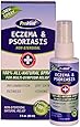 Provent Eczema and Psoriasis Care All Natural Spray, 2 Fluid Ounce
