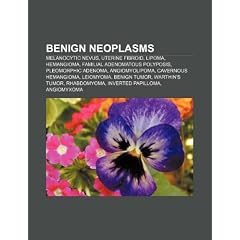 Benign neoplasms: Melanocytic nevus, Uterine fibroid, Lipoma, Hemangioma, Familial... by Source: Wikipedia