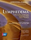 Lymphedema: Understanding and Managing Lymphedema After Cancer Treatment