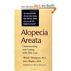 Alopecia Areata: Understanding and Coping with Hair Loss