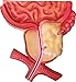 Herindera Prostate Cancer RS.1500.00