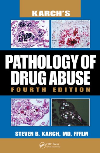 Karch's Pathology of Drug Abuse, Fourth Edition