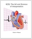 ECG Interpretation