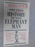 The true history of the 'Elephant Man'