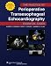 The Practice of Perioperative Transesophageal Echocardiography: Essential Cases