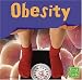 Obesity (First Facts)