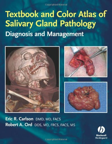 Textbook and Color Atlas of Salivary Gland Pathology: Diagnosis and Management