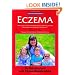Eczema