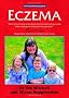 Eczema