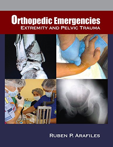 Orthopedic Emergencies: Extremity and Pelvic Trauma