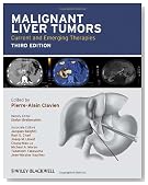 Malignant Liver Tumors: Current and Emerging Therapies