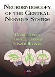 Neuroendoscopy of the Central Nervous System