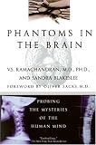 Phantoms in the Brain