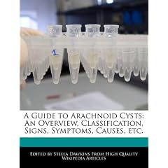 A Guide to Arachnoid Cysts: An Overview, Classification, Signs, Symptoms, Causes, etc. by Stella Dawkins