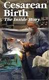 Cesarean Birth: The Inside Story [VHS]