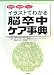 イラストでわかる脳卒中ケア事典―再発予防・家庭介護・リハビリ