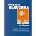 Imaging in Glaucoma by Joel S. Schuman