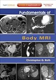 Produkt-Bild: Fundamentals of Body MRI (Fundamentals of Radiology)
