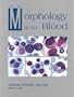 Morphology of the Blood