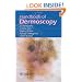 Handbook of Dermoscopy