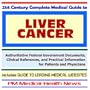 21st Century Complete Medical Guide to Liver Cancer - Authoritative Government Documents and Clinical References for Patients and Physicians with ... on Diagnosis and Treatment Options