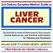 21st Century Complete Medical Guide to Liver Cancer - Authoritative Government Documents and Clinical References for Patients and Physicians with Practical ... on Diagnosis and Treatment Options