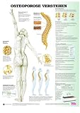 Poster für Pflefeberufe. Set aus 6 Postern: Parkinson, Alzheimer, Menopause, Osteoporose, Diabetes, Schlaganfall)