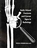 Easily Missed Fractures and Corner Signs in Radiology
