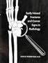 Easily Missed Fractures and Corner Signs in Radiology