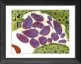 Framed Print of Toxoplasmosis from Science Photo Library