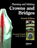  : Planning and Making Crowns and Bridges
