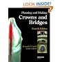 Planning and Making Crowns and Bridges