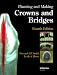 Books : Planning and Making Crowns and Bridges