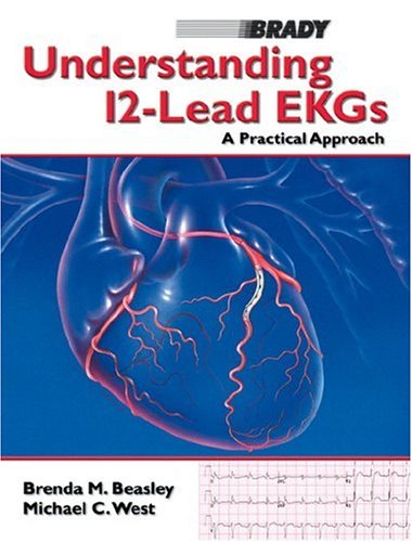 understanding 12 lead ekgs a practical approach