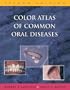 Color Atlas of Common Oral Diseases