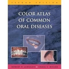 Color Atlas of Common Oral Diseases