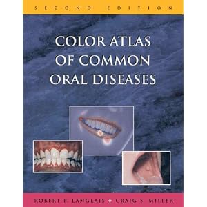 Click here to buy Color Atlas of Common Oral Diseases by Robert P. Langlais and Craig S. Miller.