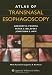 Atlas of Transnasal Esophagoscopy
