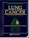 Lung Cancer: Principles and Practice