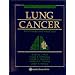 Lung Cancer: Principles and Practice