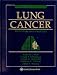 Books : Lung Cancer: Principles and Practice
