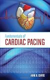 Fundamentals of Cardiac Pacing