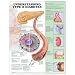 Chart - Understanding Type 2 Diabetes