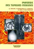 Les tumeurs osseuses