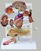 Diabetes Type 2 Anatomical Organ Model Set- Brain, Eye, Heart, Kidney, Artery, Pancreas, Foot