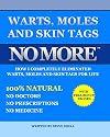 Warts, Moles And Skin Tags No More!: How I Completely Eliminated Warts, Moles & Skin Tags For Life (Volume 801)