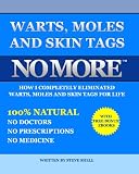 Warts, Moles And Skin Tags No More!: How I Completely Eliminated Warts, Moles & Skin Tags For Life