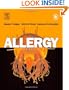 Allergy, 3e