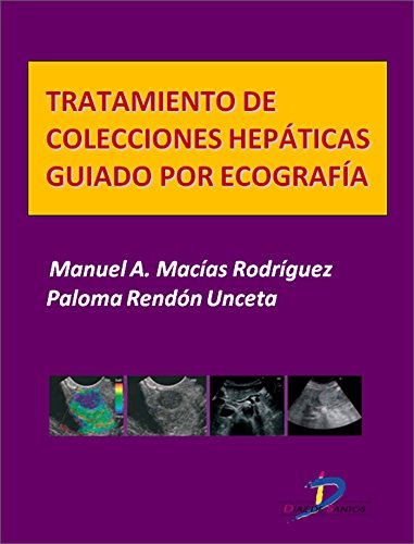 Tratamiento de colecciones hepáticas guiado por ecografía  (Este capítulo pertenece al libro Tratado de ultrasonografía abdominal) (Spanish Edition)